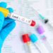 lead blood test